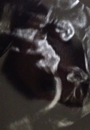 Week 27 sonogram baby b